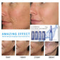 Face Serum