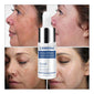 Hyaluronic Acid Serum